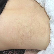 TATTOO刺青